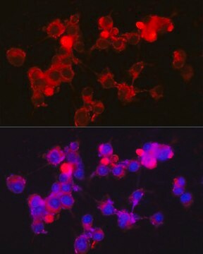 Anti-NPY5R Antibody, clone 8E4F9, Rabbit Monoclonal