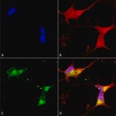 Monoclonal Anti-KCNJ2 antibody produced in mouse clone S112B-14, 1&#160;mg/mL, purified immunoglobulin