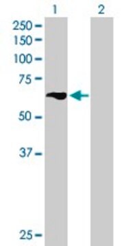 Anti-TBRG4 antibody produced in mouse purified immunoglobulin, buffered aqueous solution