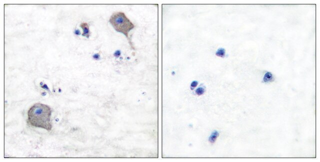 Anti-Claudin 5, C-Terminal antibody produced in rabbit affinity isolated antibody