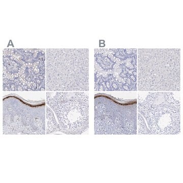 Anti-FLG antibody produced in rabbit Prestige Antibodies&#174; Powered by Atlas Antibodies, affinity isolated antibody, buffered aqueous glycerol solution, ab2