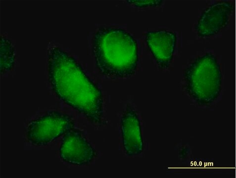 Anti-RHOQ antibody produced in mouse purified immunoglobulin, buffered aqueous solution