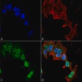 Monoclonal Anti-Sur1 - Fitc antibody produced in mouse clone S289-16, purified immunoglobulin