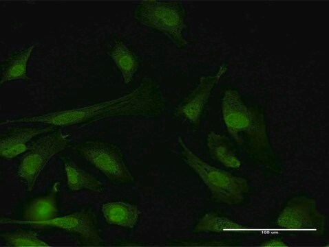 Anti-PPP6C antibody produced in mouse purified immunoglobulin, buffered aqueous solution