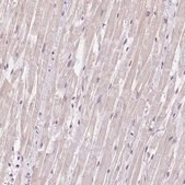 Anti-TNNT3 antibody produced in rabbit Prestige Antibodies&#174; Powered by Atlas Antibodies, affinity isolated antibody, buffered aqueous glycerol solution