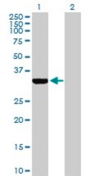 Anti-ECH1 antibody produced in rabbit purified immunoglobulin, buffered aqueous solution