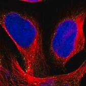 Anti-HGS antibody produced in rabbit Prestige Antibodies&#174; Powered by Atlas Antibodies, affinity isolated antibody, buffered aqueous glycerol solution