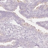 Anti-ZBBX antibody produced in rabbit Prestige Antibodies&#174; Powered by Atlas Antibodies, affinity isolated antibody, buffered aqueous glycerol solution