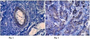 Anti-Laminin alpha 5 Antibody, clone 4B12 clone 4B12, from mouse