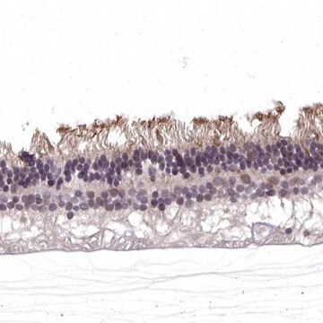 Anti-RGS9BP antibody produced in rabbit Prestige Antibodies&#174; Powered by Atlas Antibodies, affinity isolated antibody, buffered aqueous glycerol solution