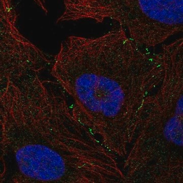 Anti-VCAM1 antibody produced in rabbit Prestige Antibodies&#174; Powered by Atlas Antibodies, affinity isolated antibody