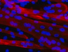 Monoclonal Anti-Myosin (Skeletal, Fast)&#8722;Alkaline Phosphatase antibody produced in mouse clone MY-32, purified from hybridoma cell culture
