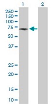 Anti-ATP6V1B1 antibody produced in rabbit purified immunoglobulin, buffered aqueous solution