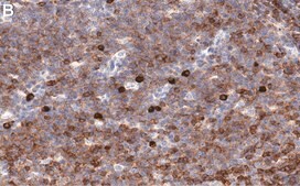 Anti-Fyn Antibody, clone 2F15 ZooMAb&#174; Rabbit Monoclonal recombinant, expressed in HEK 293 cells