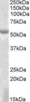 Anti-EYA1 antibody produced in goat affinity isolated antibody, buffered aqueous solution