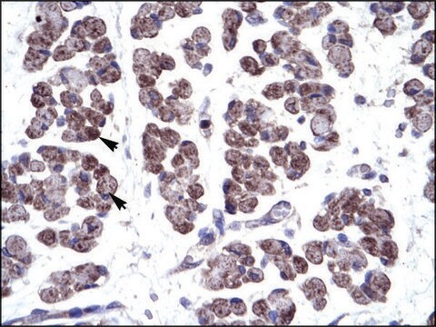 Anti-TBX20 (AB1) antibody produced in rabbit affinity isolated antibody