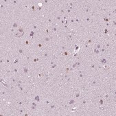 Monoclonal Anti-SOX9 antibody produced in mouse Prestige Antibodies&#174; Powered by Atlas Antibodies, clone CL0639, purified immunoglobulin, buffered aqueous glycerol solution