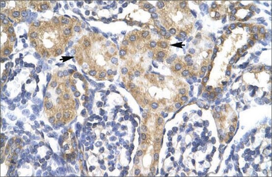 Anti-ACSL1 (AB1) antibody produced in rabbit affinity isolated antibody