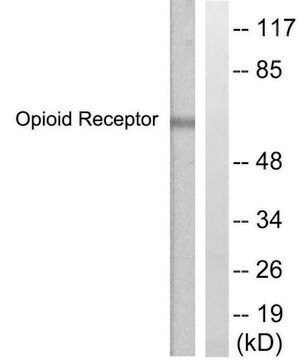 Anti-CCR5, C-Terminal antibody produced in rabbit affinity isolated antibody