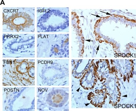 Anti-FBN1 antibody produced in rabbit Prestige Antibodies&#174; Powered by Atlas Antibodies, affinity isolated antibody, buffered aqueous glycerol solution