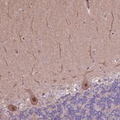 Anti-HDAC5 antibody produced in rabbit Prestige Antibodies&#174; Powered by Atlas Antibodies, affinity isolated antibody, buffered aqueous glycerol solution