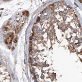 Anti-ASCC3 antibody produced in rabbit Prestige Antibodies&#174; Powered by Atlas Antibodies, affinity isolated antibody, buffered aqueous glycerol solution, ab3