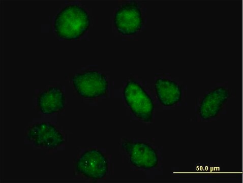 Anti-PFKFB3 antibody produced in mouse IgG fraction of antiserum, buffered aqueous solution