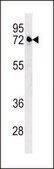 ANTI-KLHL24 (CENTER) antibody produced in rabbit IgG fraction of antiserum, buffered aqueous solution