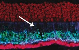 Anti-Pigment Epithelium Derived Factor Antibody, clone 10F12.2 clone 10F12.2, Chemicon&#174;, from mouse