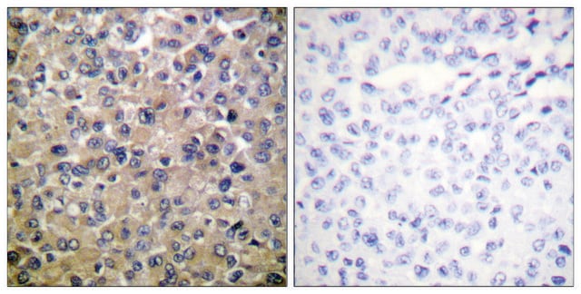 Anti-PP1-&#945; antibody produced in rabbit affinity isolated antibody