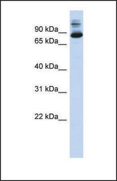 Anti-SIX4, (N-terminal) antibody produced in rabbit affinity isolated antibody