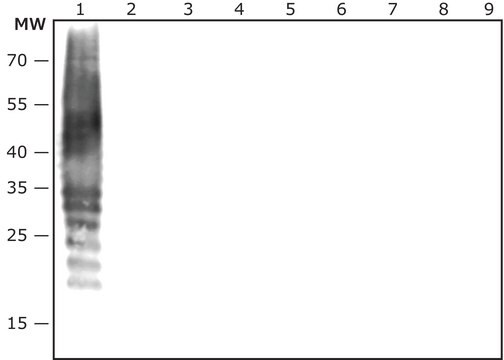 Anti-Porphyromonas gingivalis antibody produced in rabbit IgG fraction of antiserum