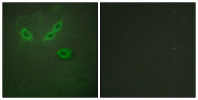 Anti-TUSC5 antibody produced in rabbit affinity isolated antibody