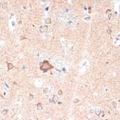 Anti-ADORA1 antibody produced in rabbit