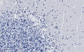 Anti-Maxi K/BK channel Antibody, clone 3D15 ZooMAb&#174; Rabbit Monoclonal recombinant, expressed in HEK 293 cells