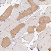 Anti-MYH6 antibody produced in rabbit Prestige Antibodies&#174; Powered by Atlas Antibodies, affinity isolated antibody, buffered aqueous glycerol solution