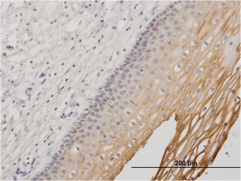 Monoclonal Anti-MUC1 antibody produced in mouse clone 1B7, purified immunoglobulin, buffered aqueous solution