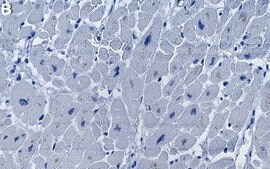 Anti-OXCT1 Antibody, clone 1B11 ZooMAb&#174; Rabbit Monoclonal recombinant, expressed in HEK 293 cells