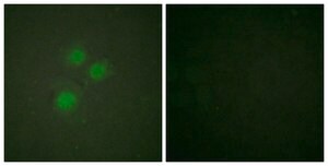 Anti-NIFK antibody produced in rabbit affinity isolated antibody