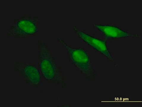 ANTI-PBK antibody produced in mouse clone 2D2, purified immunoglobulin, buffered aqueous solution