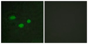 Anti-DNMT3B antibody produced in rabbit affinity isolated antibody