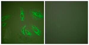Anti-Gastrin antibody produced in rabbit affinity isolated antibody