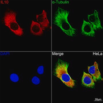 Anti-IL10 Antibody, clone 6U0G7, Rabbit Monoclonal