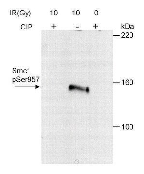 Rabbit anti-Phospho SMC1 (S957) Antibody, Affinity Purified Powered by Bethyl Laboratories, Inc.