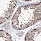 Anti-EPB41L5 antibody produced in rabbit Prestige Antibodies&#174; Powered by Atlas Antibodies, affinity isolated antibody, buffered aqueous glycerol solution