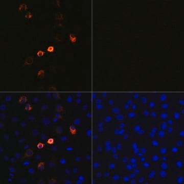 Monoclonal Anti-2019-nCoV Spike antibody produced in Rabbit