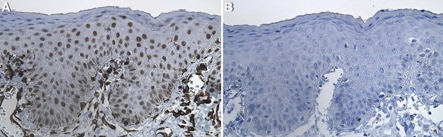 Anti-POU2F3 Antibody, clone 1L11 ZooMAb&#174; Rabbit Monoclonal recombinant, expressed in HEK 293 cells