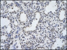 Anti-DDX17 antibody produced in rabbit IgG fraction of antiserum