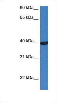 Anti-OTC antibody produced in rabbit affinity isolated antibody