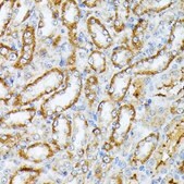 Anti-Caspase 1 antibody produced in rabbit